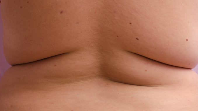 Para mantener a raya la obesidad, el color de los michelines importa